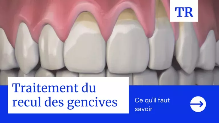 découvrez des méthodes naturelles efficaces pour dégonfler vos gencives rapidement et soulager l'inflammation sans médicaments.